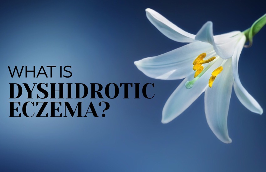 what is dyshidrotic eczema?